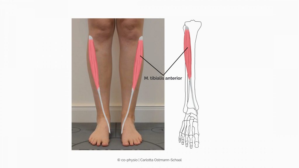 M. tibialis anterior - vorderer Schienbeinmuskel