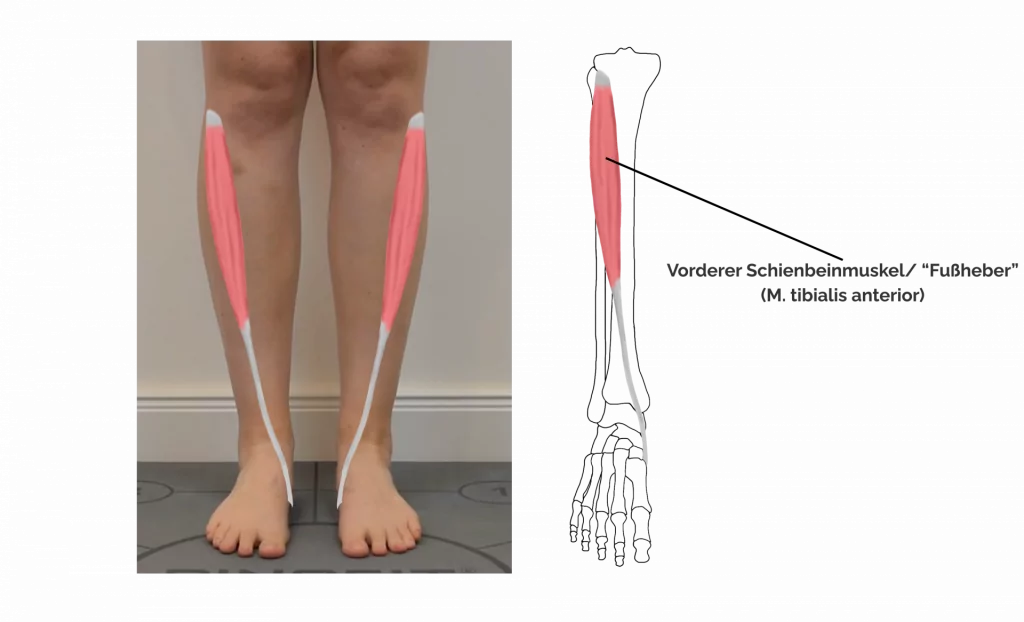 Abbildung Vorderer Schienbeinmuskel, Fußheber, M. tibialis anterior